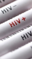 روابط جنسی مهمترین عامل ابتلا به ایدز در سال جاری بود